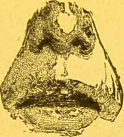 An illustration from La physionomie chez l'homme et chez les animaux, dans ses rapports avec l'expression des émotions et des sentiments / S. Schack. (1887)