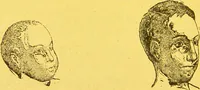 Picture 12 of 36 from La physionomie chez l'homme et chez les animaux, dans ses rapports avec l'expression des émotions et des sentiments / S. Schack. (1887), leaf 154