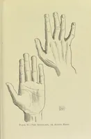 An illustration from A manual of cheirosophy : being a complete practical handbook of the twin sciences of cheirognomy and cheiromancy, by means whereof the past, the present, and the future may be read in the formations of the hands ; preceded by an introductory argument upon the science of cheirosophy and its claims to rank as a physical science / by Ed. Heron-Allen ; with full-page and other illustrations by Rosamund Brunel Horsley. (1885)