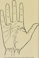 Picture 18 of 32 from A manual of cheirosophy : being a complete practical handbook of the twin sciences of cheirognomy and cheiromancy, by means whereof the past, the present, and the future may be read in the formations of the hands ; preceded by an introductory argument upon the science of cheirosophy and its claims to rank as a physical science / by Ed. Heron-Allen ; with full-page and other illustrations by Rosamund Brunel Horsley. (1885), leaf 240