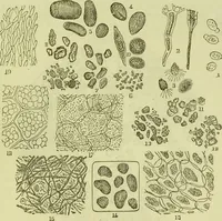An illustration from The microscope : its history, construction, and application, being a familiar introduction to the use of the instrument, and the study of microscopical science / by Jabez Hogg ; with upwards of five hundred engravings, and coloured illustrations by Tuffen West. (1890)