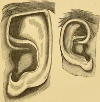 Picture 44 of 220 from Nature's revelations of character, or, The mental, moral and volitive dispositions of mankind, as manifested in the human form and countenance / by Joseph Simms. (1873), leaf 181
