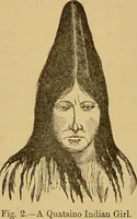 An illustration from Nature's revelations of character, or, The mental, moral and volitive dispositions of mankind, as manifested in the human form and countenance / by Joseph Simms. (1873)