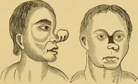 An illustration from Nature's revelations of character, or, The mental, moral and volitive dispositions of mankind, as manifested in the human form and countenance / by Joseph Simms. (1873)
