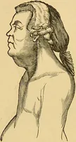 An illustration from Nature's revelations of character, or, The mental, moral and volitive dispositions of mankind, as manifested in the human form and countenance / by Joseph Simms. (1873)