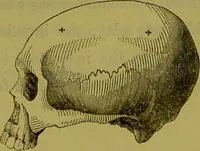 An illustration from On the functions of the cerebellum / by Drs. Gall, Vimont, and Broussais ; translated from the French by George Combe: also answers to the objections urged against phrenology by Drs. Roget, Rudolphi, Prichard, and Tiedemann; by George Combe and A. Combe. (1838)