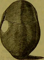 An illustration from On the functions of the cerebellum / by Drs. Gall, Vimont, and Broussais ; translated from the French by George Combe: also answers to the objections urged against phrenology by Drs. Roget, Rudolphi, Prichard, and Tiedemann; by George Combe and A. Combe. (1838)