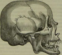 An illustration from Review of Morton's Crania Americana. (1840)