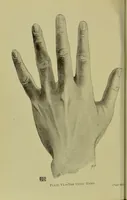 An illustration from The science of the hand, or, The art of recognising the tendencies of the human mind by the observation of the formations of the hands = la science de la main / translated from the French of C.S. D'Arpentigny and edited ... by Ed. Heron-Allen ; with original plates and explanatory diagrams by Rosamund Brunel Horsley. (1886)