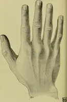 An illustration from The science of the hand, or, The art of recognising the tendencies of the human mind by the observation of the formations of the hands = la science de la main / translated from the French of C.S. D'Arpentigny and edited ... by Ed. Heron-Allen ; with original plates and explanatory diagrams by Rosamund Brunel Horsley. (1886)