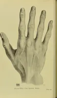 Picture 13 of 16 from The science of the hand, or, The art of recognising the tendencies of the human mind by the observation of the formations of the hands = la science de la main / translated from the French of C.S. D'Arpentigny and edited ... by Ed. Heron-Allen ; with original plates and explanatory diagrams by Rosamund Brunel Horsley. (1886), leaf 370