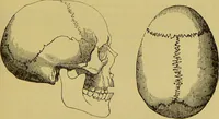 An illustration from Thesaurus craniorum : catalogue of the skulls of the various races of man, in the collection of Joseph Barnard Davis. (1867)