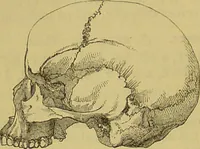 An illustration from Thesaurus craniorum : catalogue of the skulls of the various races of man, in the collection of Joseph Barnard Davis. (1867)