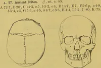 An illustration from Thesaurus craniorum : catalogue of the skulls of the various races of man, in the collection of Joseph Barnard Davis. (1867)