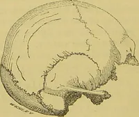 An illustration from Thesaurus craniorum : catalogue of the skulls of the various races of man, in the collection of Joseph Barnard Davis. (1867)