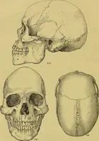 An illustration from Thesaurus craniorum : catalogue of the skulls of the various races of man, in the collection of Joseph Barnard Davis. (1867)