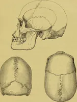 An illustration from Thesaurus craniorum : catalogue of the skulls of the various races of man, in the collection of Joseph Barnard Davis. (1867)