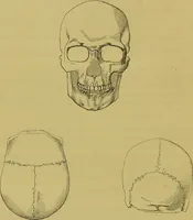 An illustration from Thesaurus craniorum : catalogue of the skulls of the various races of man, in the collection of Joseph Barnard Davis. (1867)