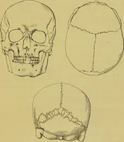 An illustration from Thesaurus craniorum : catalogue of the skulls of the various races of man, in the collection of Joseph Barnard Davis. (1867)