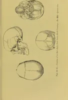 An illustration from Thesaurus craniorum : catalogue of the skulls of the various races of man, in the collection of Joseph Barnard Davis. (1867)