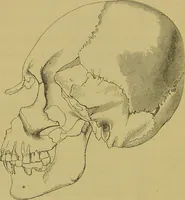 An illustration from Thesaurus craniorum : catalogue of the skulls of the various races of man, in the collection of Joseph Barnard Davis. (1867)