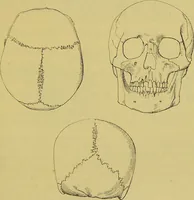 An illustration from Thesaurus craniorum : catalogue of the skulls of the various races of man, in the collection of Joseph Barnard Davis. (1867)