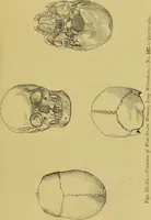 An illustration from Thesaurus craniorum : catalogue of the skulls of the various races of man, in the collection of Joseph Barnard Davis. (1867)
