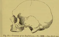 Picture 17 of 41 from Thesaurus craniorum : catalogue of the skulls of the various races of man, in the collection of Joseph Barnard Davis. (1867), leaf 71