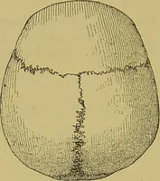 An illustration from Thesaurus craniorum : catalogue of the skulls of the various races of man, in the collection of Joseph Barnard Davis. (1867)