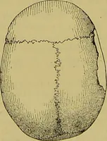 An illustration from Thesaurus craniorum : catalogue of the skulls of the various races of man, in the collection of Joseph Barnard Davis. (1867)