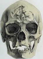 An illustration from Zur Morphologie der Rassen-Schädel : einleitende Bemerkungen und Beiträge, ein Sendschreiben an ... Carl Ernst v. Baer / von Joh. Christ. Gustav Lucae. (1861)