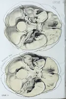 Picture 22 of 72 from Zur Morphologie der Rassen-Schädel : einleitende Bemerkungen und Beiträge, ein Sendschreiben an ... Carl Ernst v. Baer / von Joh. Christ. Gustav Lucae. (1861), leaf 132