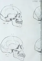An illustration from Zur Morphologie der Rassen-Schädel : einleitende Bemerkungen und Beiträge, ein Sendschreiben an ... Carl Ernst v. Baer / von Joh. Christ. Gustav Lucae. (1861)