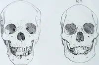 An illustration from Zur Morphologie der Rassen-Schädel : einleitende Bemerkungen und Beiträge, ein Sendschreiben an ... Carl Ernst v. Baer / von Joh. Christ. Gustav Lucae. (1861)