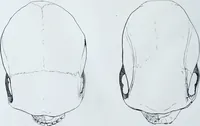 Picture 26 of 72 from Zur Morphologie der Rassen-Schädel : einleitende Bemerkungen und Beiträge, ein Sendschreiben an ... Carl Ernst v. Baer / von Joh. Christ. Gustav Lucae. (1861), leaf 140