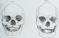 Picture 27 of 72 from Zur Morphologie der Rassen-Schädel : einleitende Bemerkungen und Beiträge, ein Sendschreiben an ... Carl Ernst v. Baer / von Joh. Christ. Gustav Lucae. (1861), leaf 141