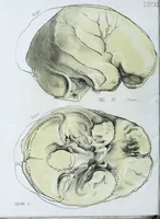 Picture 28 of 72 from Zur Morphologie der Rassen-Schädel : einleitende Bemerkungen und Beiträge, ein Sendschreiben an ... Carl Ernst v. Baer / von Joh. Christ. Gustav Lucae. (1861), leaf 144