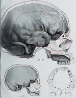 Picture 30 of 72 from Zur Morphologie der Rassen-Schädel : einleitende Bemerkungen und Beiträge, ein Sendschreiben an ... Carl Ernst v. Baer / von Joh. Christ. Gustav Lucae. (1861), leaf 153