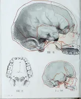 Picture 31 of 72 from Zur Morphologie der Rassen-Schädel : einleitende Bemerkungen und Beiträge, ein Sendschreiben an ... Carl Ernst v. Baer / von Joh. Christ. Gustav Lucae. (1861), leaf 156