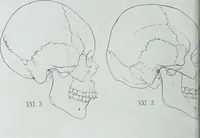 Picture 34 of 72 from Zur Morphologie der Rassen-Schädel : einleitende Bemerkungen und Beiträge, ein Sendschreiben an ... Carl Ernst v. Baer / von Joh. Christ. Gustav Lucae. (1861), leaf 164