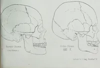 Picture 37 of 72 from Zur Morphologie der Rassen-Schädel : einleitende Bemerkungen und Beiträge, ein Sendschreiben an ... Carl Ernst v. Baer / von Joh. Christ. Gustav Lucae. (1861), leaf 165