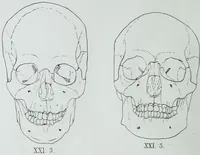 An illustration from Zur Morphologie der Rassen-Schädel : einleitende Bemerkungen und Beiträge, ein Sendschreiben an ... Carl Ernst v. Baer / von Joh. Christ. Gustav Lucae. (1861)