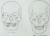 An illustration from Zur Morphologie der Rassen-Schädel : einleitende Bemerkungen und Beiträge, ein Sendschreiben an ... Carl Ernst v. Baer / von Joh. Christ. Gustav Lucae. (1861)