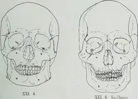 Picture 40 of 72 from Zur Morphologie der Rassen-Schädel : einleitende Bemerkungen und Beiträge, ein Sendschreiben an ... Carl Ernst v. Baer / von Joh. Christ. Gustav Lucae. (1861), leaf 169