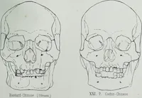 Picture 41 of 72 from Zur Morphologie der Rassen-Schädel : einleitende Bemerkungen und Beiträge, ein Sendschreiben an ... Carl Ernst v. Baer / von Joh. Christ. Gustav Lucae. (1861), leaf 169