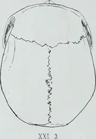 An illustration from Zur Morphologie der Rassen-Schädel : einleitende Bemerkungen und Beiträge, ein Sendschreiben an ... Carl Ernst v. Baer / von Joh. Christ. Gustav Lucae. (1861)