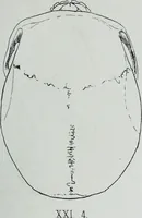 An illustration from Zur Morphologie der Rassen-Schädel : einleitende Bemerkungen und Beiträge, ein Sendschreiben an ... Carl Ernst v. Baer / von Joh. Christ. Gustav Lucae. (1861)