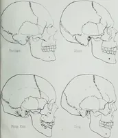 Picture 50 of 72 from Zur Morphologie der Rassen-Schädel : einleitende Bemerkungen und Beiträge, ein Sendschreiben an ... Carl Ernst v. Baer / von Joh. Christ. Gustav Lucae. (1861), leaf 177