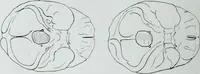 An illustration from Zur Morphologie der Rassen-Schädel : einleitende Bemerkungen und Beiträge, ein Sendschreiben an ... Carl Ernst v. Baer / von Joh. Christ. Gustav Lucae. (1861)