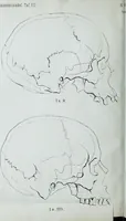 Picture 67 of 72 from Zur Morphologie der Rassen-Schädel : einleitende Bemerkungen und Beiträge, ein Sendschreiben an ... Carl Ernst v. Baer / von Joh. Christ. Gustav Lucae. (1861), leaf 198